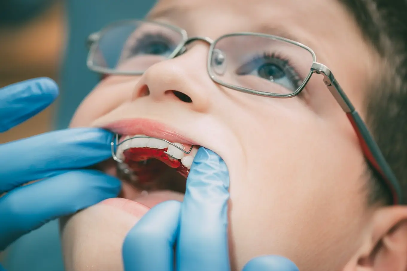 dziecko u ortodonty