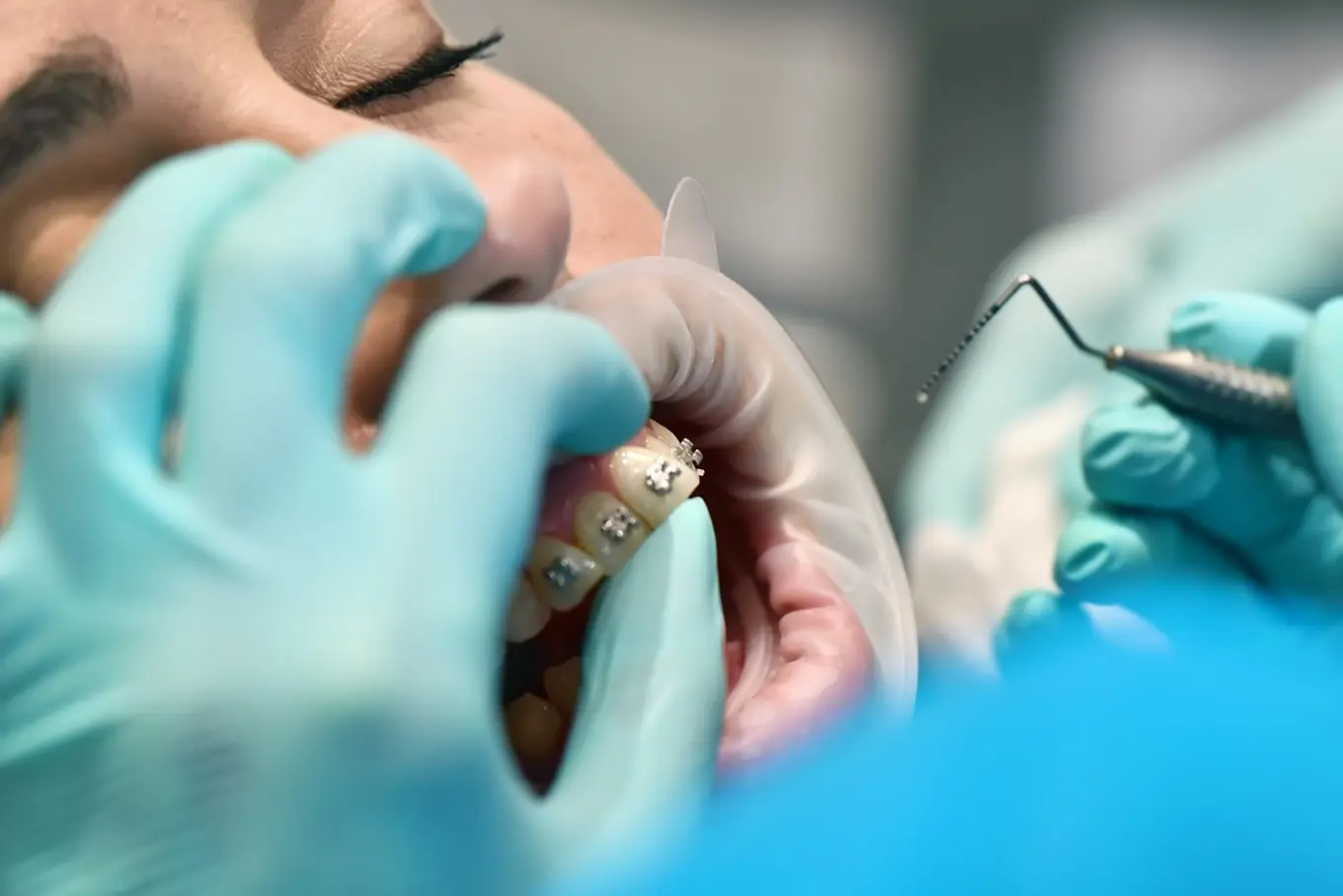 leczenie ortodontyczne