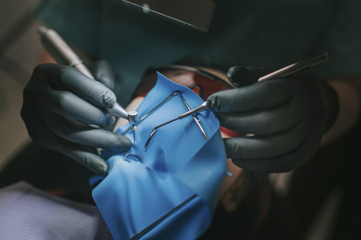 leczenie zębów pod narkozą